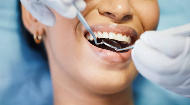 Best Urgent Care for Lost Fillings or Crowns in Elsberry, MO